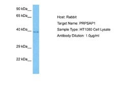PAP39 Antibody, Novus Biologicals 100 &mu;L; Unconjugated:Antibodies, Polyclonal